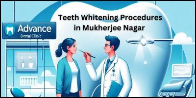 Teeth Whitening Procedures in Mukherjee Nagar.jpg