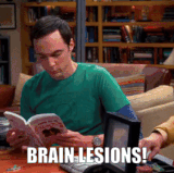 Sheldon brain lesions! (1).gif