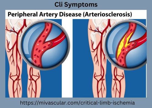 Best Cli Symptoms.jpg