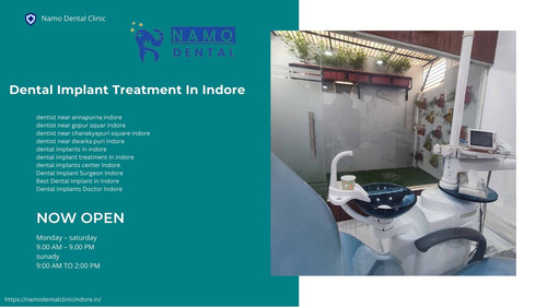 Dental Implant Treatment In Indore.jpg