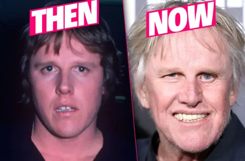 gary busey plastic surgery pp 02.webp