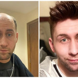 the benefits of using men's wigs for hair thinning
