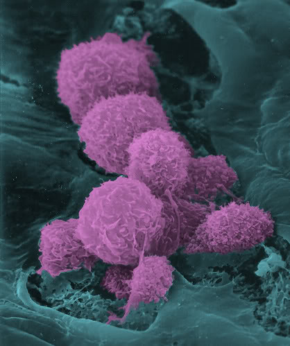 Macrophage.jpg
