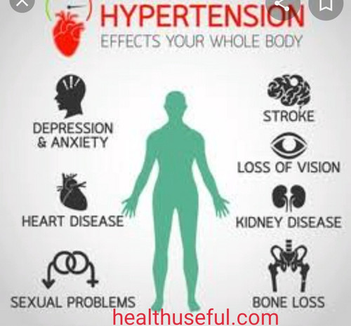 Hypertension-Eitiology of Hypertension.jpg