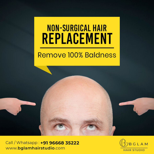 Best Hair Replacement.jpg