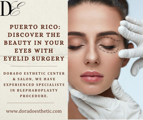 Transformation in Puerto Rico Discover the Beauty in your Eyes with Eyelid Surgery.jpg