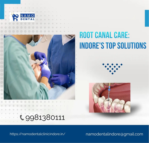 Root Canal Care Indore's Top Solutions.jpg
