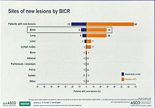 GPF KegXgCApnNL?format=jpg.jpg