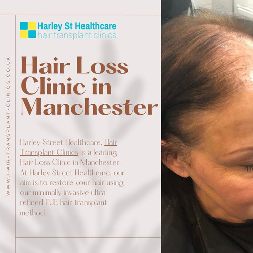 Hair Loss Clinic in Manchester (2).jpg