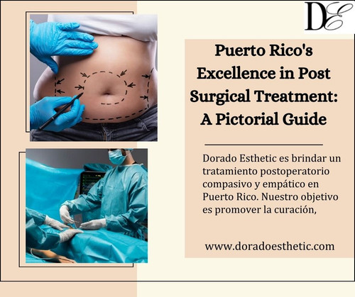 Puerto Rico's Excellence in Post Surgical Treatment A Pictorial Guide.jpg