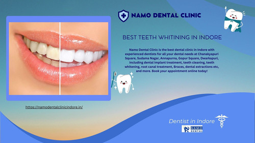 Best Teeth Whitining in Indore.jpg