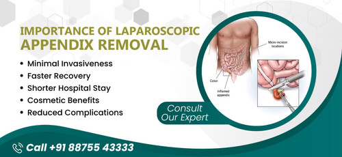 Top Rated Appendix Removal by Laparoscopy in Kota Jindal Laparoscopy.jpg