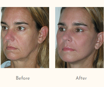 Skin specialist in andheri west.png