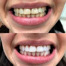 images (2).jpg
