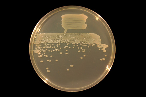 Pseudomonas fluorescens on TY agar %28white light%29