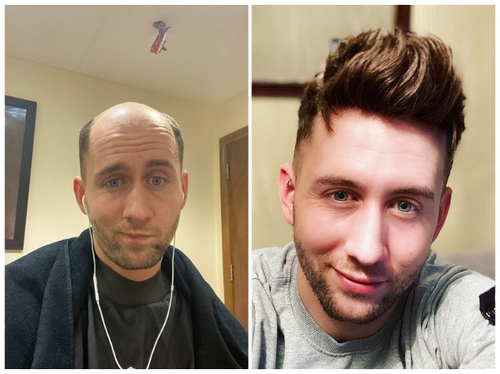 How I stick my hair system and style it at home.png