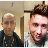How I stick my hair system and style it at home