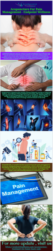 Acupuncture For Pain Management Endpoint Wellness.png