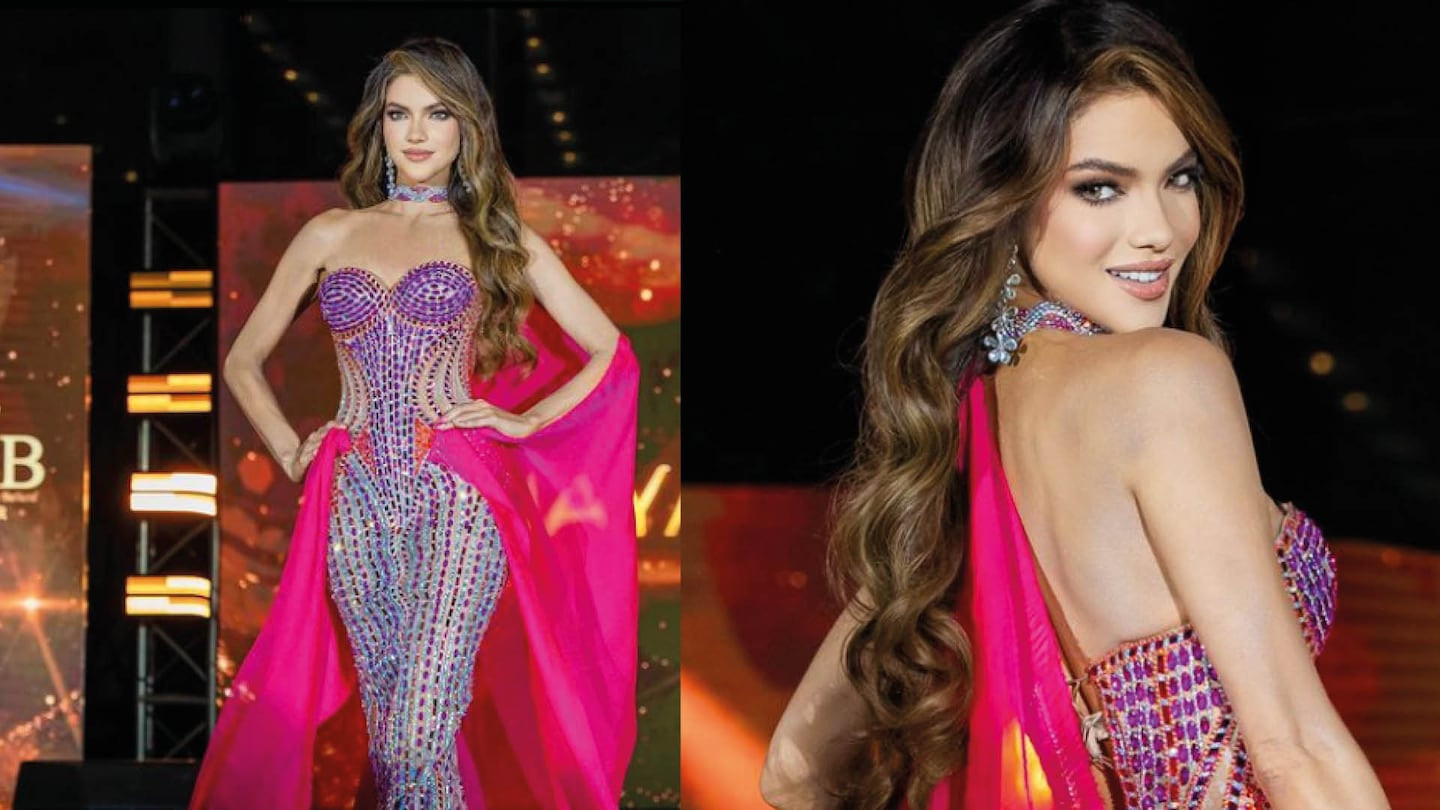 La enfermedad autoinmune que obliga a Mara Topic, Miss Universo Ecuador 2024, a seguir una dieta protocolar Jy59mAP