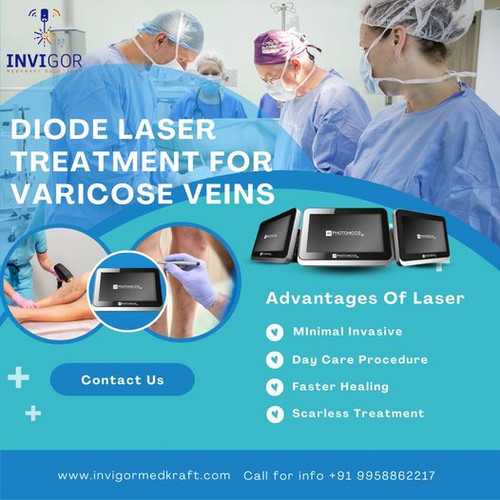 Diode Laser Treatment for Varicose Veins.jpg