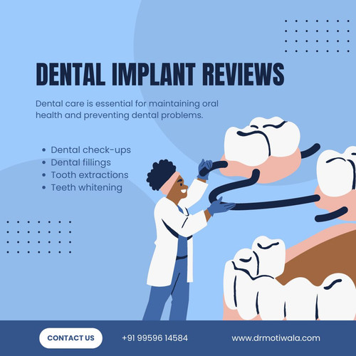 Dental Implant Reviews.jpg