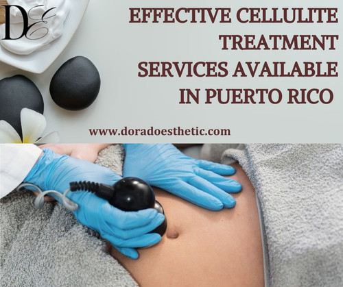 Effective Cellulite Treatment Services Available in Puerto Rico.jpg