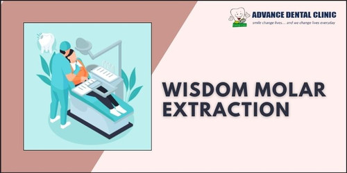 Dentist in Vijay Nagar.jpg