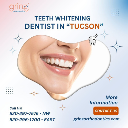 Teeth Whitening Dentist in Tucson.jpg