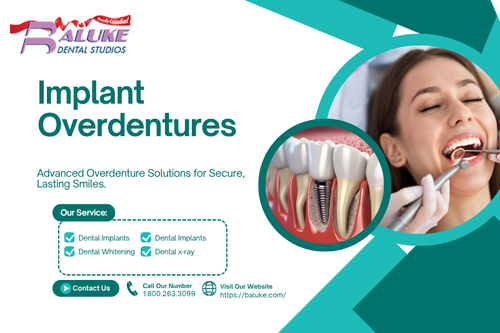 Implant Overdentures.png