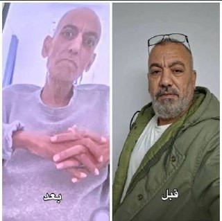 مؤسسات شؤون الأسرى الفلسطينيين: استشهاد الأسير محمود عبد الله من مخيم جنين في مستشفى أساف هروفيه الإسرائيلي...