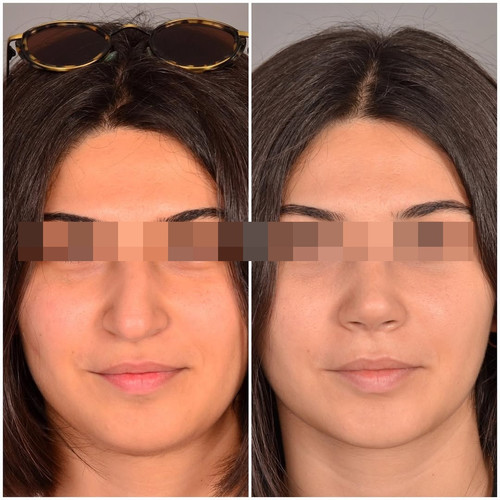 6 mnth marla (1).jpg