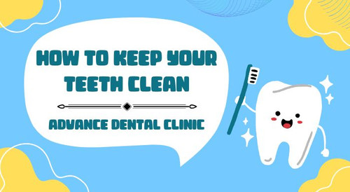 How to Keep Your Teeth Clean - Advance Dental Clinic.jpg