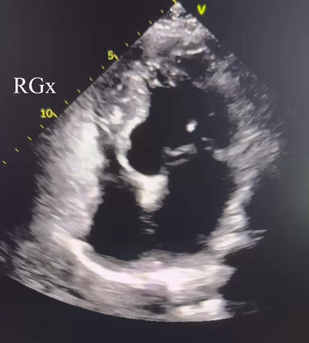 IlvONbM I9TnRh08.jpg