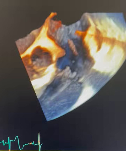 xoBXkcxEjm G6fWZ.jpg