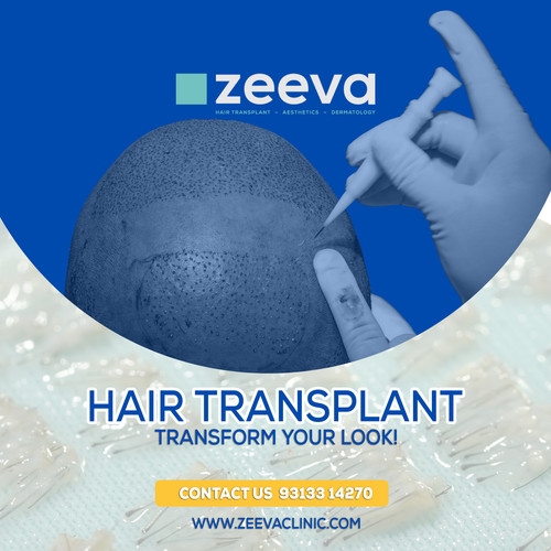 Hair Transplant Near Me.jpg