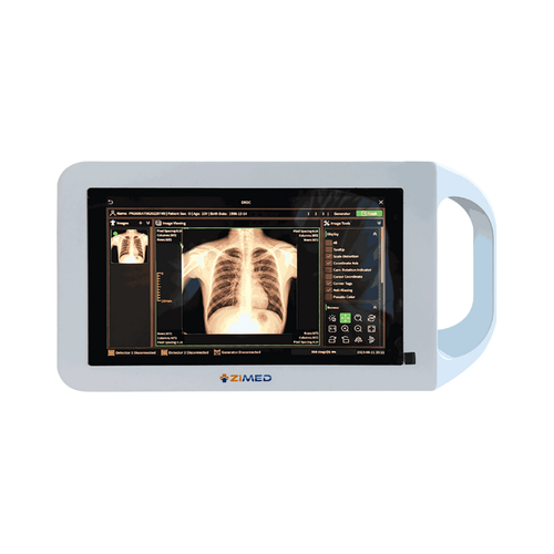 Digital Portable X Ray ZPXR A12.png
