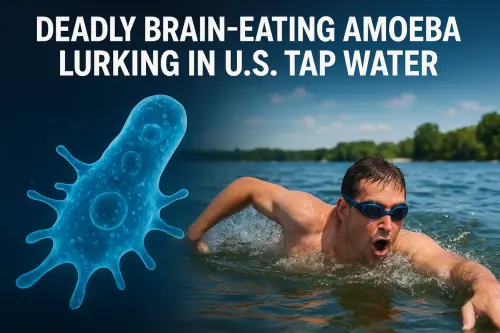 Parasite in the USA.webp