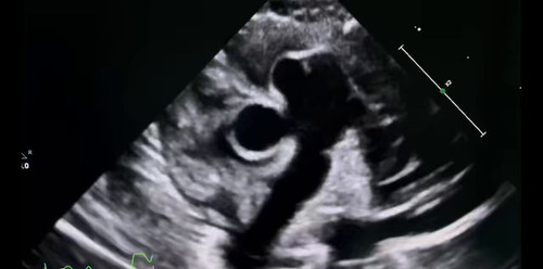 YMg7mLUm4vvbc 9i.jpg