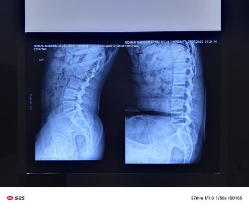 B1E5CDCB BE73 45C7 81F6 9E19833D5669.jpg