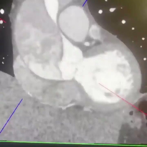 jefZ mjmdawiQLJk.jpg