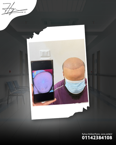hy clinic قبل وبعد (1).png