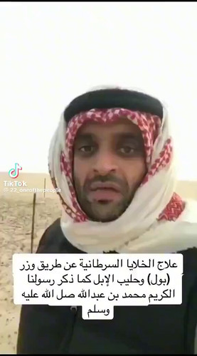 sYLAQ0M4bPUf0 XU.jpg