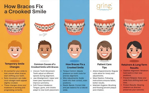 How Braces Fix a Crooked Smile.jpg