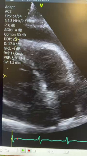 iryra1Dssgy2I FD.jpg