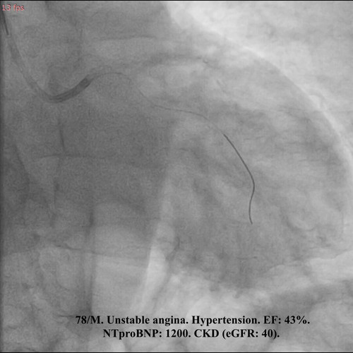 m9IAHdKhHmdYoh v.jpg