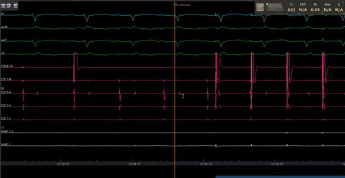 xmccIN aDEzDBVyF.jpg