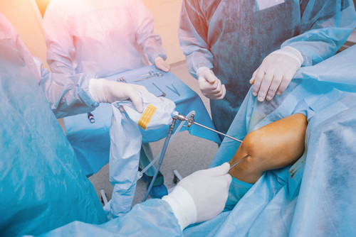 Meniscus Tear Surgery in Delhi.1