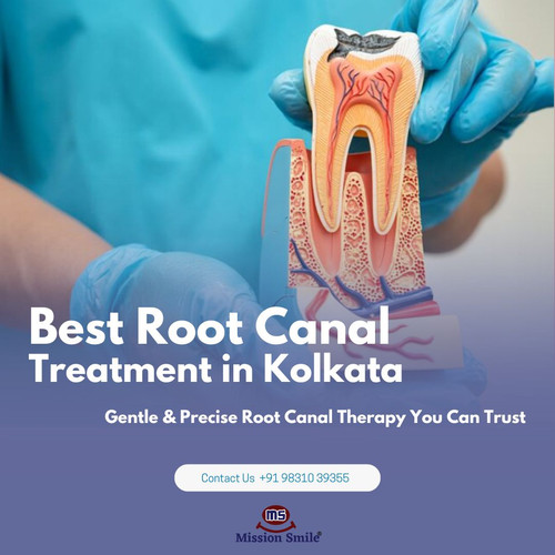 Advanced Technology for Comfortable Root Canal Treatment in Kolkata.jpg