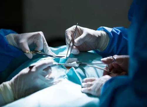 Laparoscopic Surgery in Indore.jpg