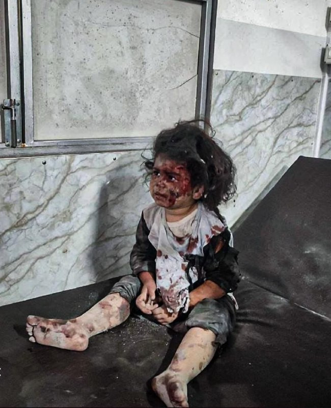 مدير مكتب الإعلام الحكومي في غزة، د. إسماعيل الثوابتة، ذكر أن هناك 104 شهيدًا وأكثر من 350 جريحًا في حالة حرجة نتيجة مجازر ارتكبها الاحتلال بالقطاع خل...